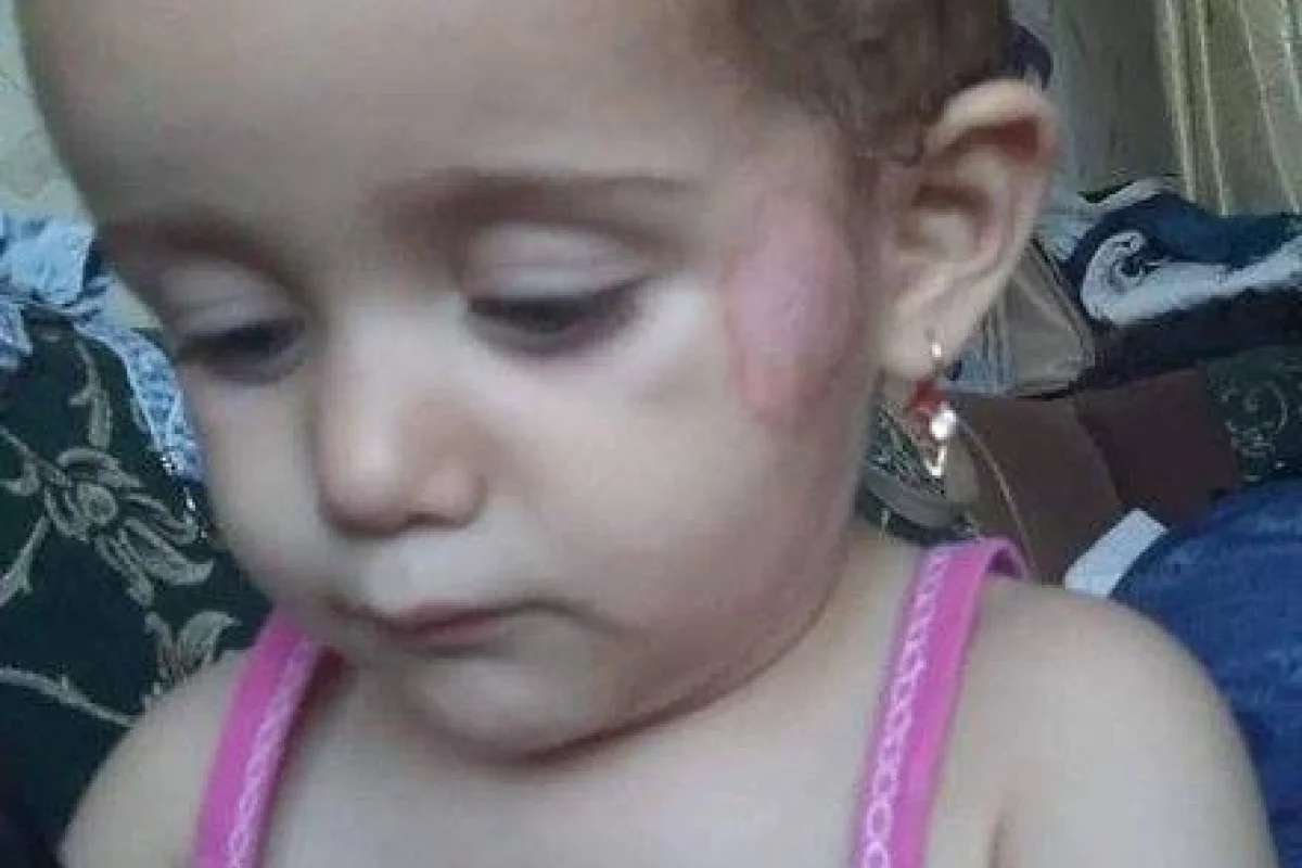 Bağçada növbəti şiddətə məruz qalan KÖRPƏ