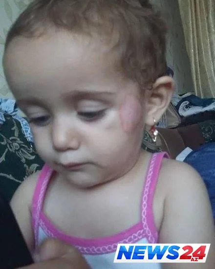 Bağçada növbəti şiddətə məruz qalan KÖRPƏ