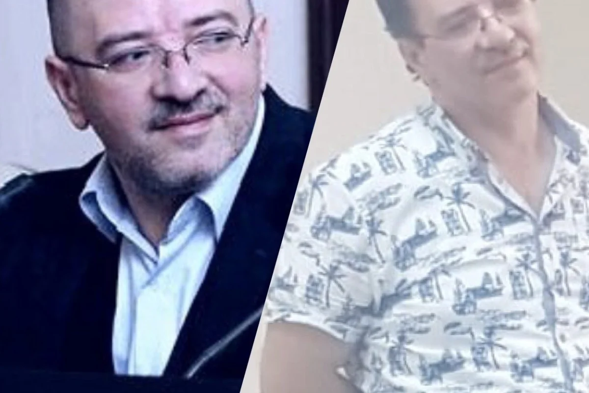 Azərbaycanlı bəstəkar saç əkdirdi - FOTOLAR