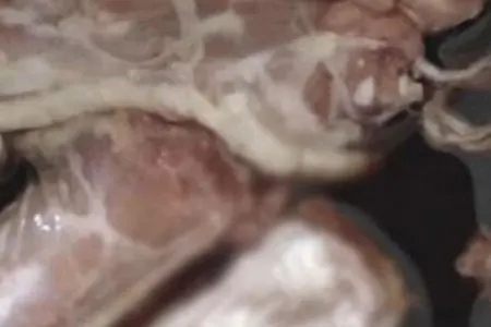 Dondurulmuş toyuğun içindən - kəsik barmaq çıxdı