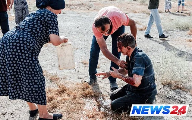 Qaradağda ağır qəza. Ölən və yaralananlar var