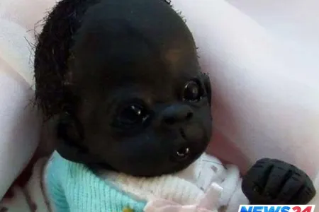 Bu körpə qapqara doğulub - FOTO