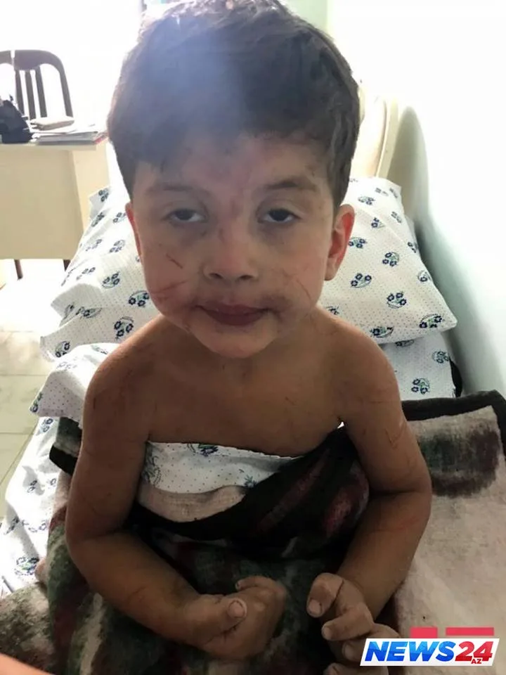 3 yaşlı uşaq belə tapıldı: Yaxınları göz yaşlarına boğuldu- FOTO-VİDEO