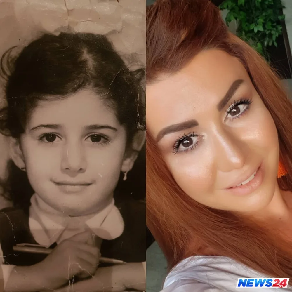 Fatimə uşaqlıq şəklini paylaşdı: “Məncə o vaxtlar botoks edən olmayıb” – FOTO