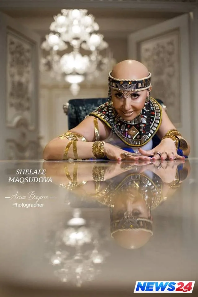 Xərçəngdən əziyyət çəkən vəkil Zülfiyyə Bayramovadan – FOTOSESSİYA