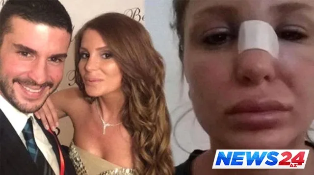 Məşhur aktyorun çılpaq görüntülərini arvadı və qaynanası yayıbmış - FOTO