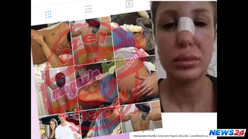 Məşhur aktyorun çılpaq görüntülərini arvadı və qaynanası yayıbmış - FOTO