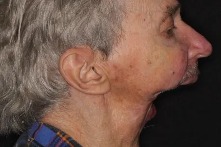 Üzünün yarısı olmayan insan necə həyatda qaldı?