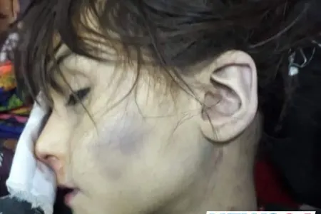 Əfqanıstanda kişi doqquz yaşlı arvadını öldürüb