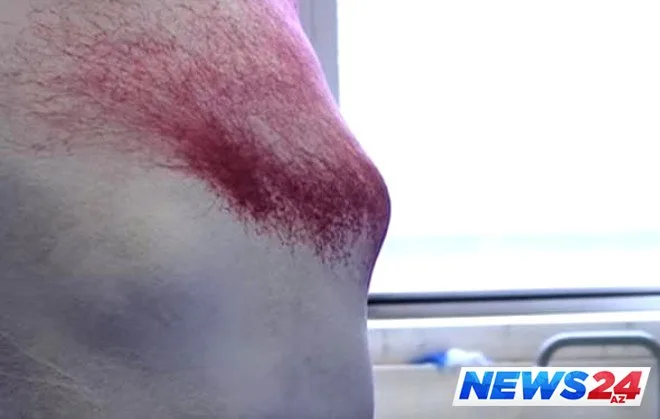 Spreydən paltar hazırlandı - FOTO- VİDEO