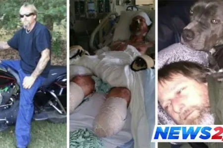 İt sahibinin ayaqlarını yaladı, sahibi ayaqsız qaldı - FOTOLAR