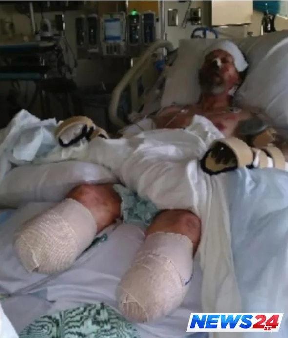 İt sahibinin ayaqlarını yaladı, sahibi ayaqsız qaldı - FOTOLAR