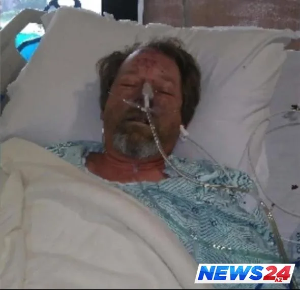 İt sahibinin ayaqlarını yaladı, sahibi ayaqsız qaldı - FOTOLAR