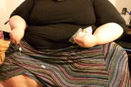 Sevgilisi ilə eyni yatağa girə bilmək üçün 192 kilo arıqladı - FOTOLAR