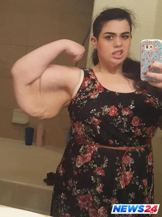 Sevgilisi ilə eyni yatağa girə bilmək üçün 192 kilo arıqladı - FOTOLAR