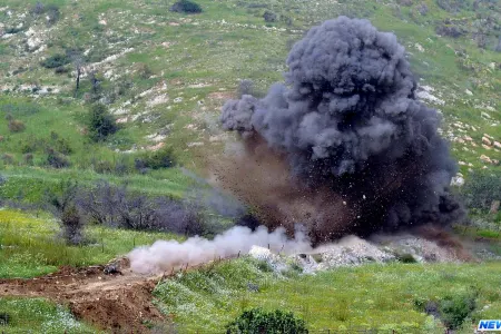 Tovuzda minaya düşən azyaşlının ayağı amputasiya olundu - VİDEO