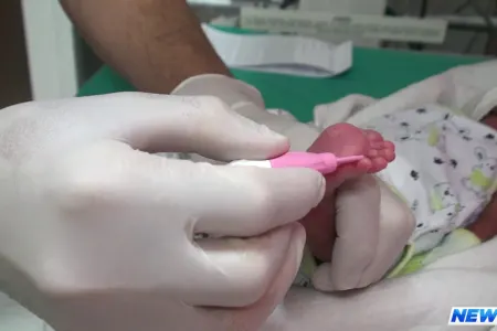 Azərbaycanda körpələrə “Topuq testi” tətbiq olunacaq