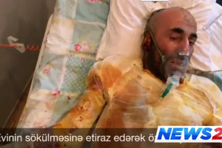 Bakıda evinin sökülməsinə etiraz edən vətəndaş özünü yandırdı – VİDEO
