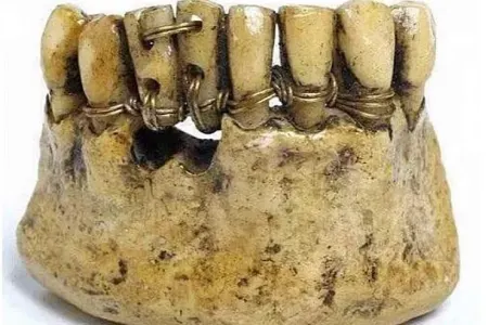 Tarixin sirlərini açan 9 çox maraqlı FOTO