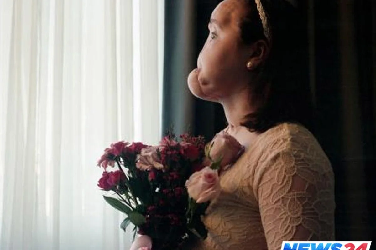 Öz üzünü məhv etmiş qız yeni simasına qovuşdu - VİDEO