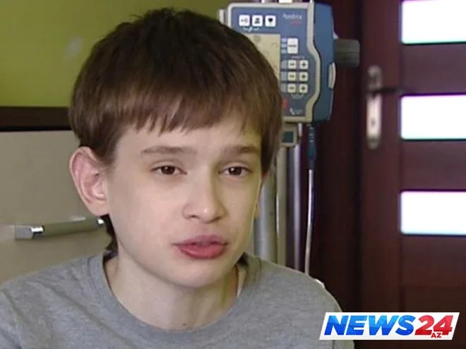 25 yaşlı gənci görənlər 12 yaşında olduğunu zənn edir