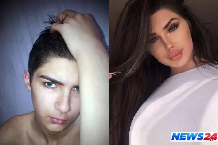 17 yaşlı transseksual Kim Kardaşyana bənzəmək üçün əməliyyat etdirdi - FOTOLAR
