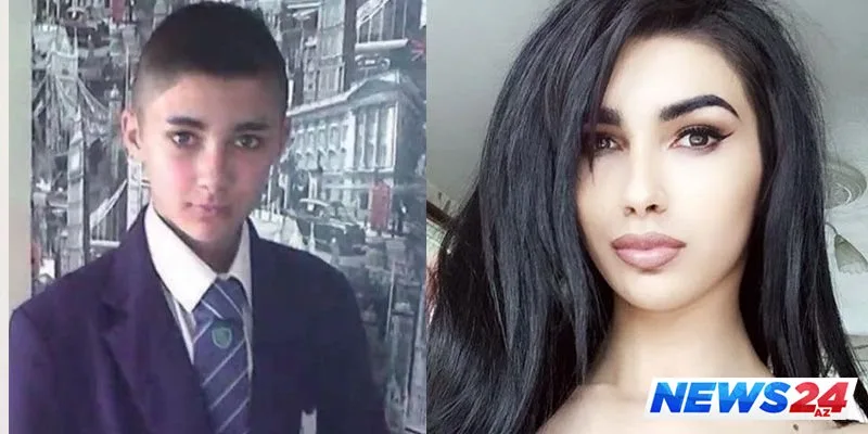 17 yaşlı transseksual Kim Kardaşyana bənzəmək üçün əməliyyat etdirdi - FOTOLAR