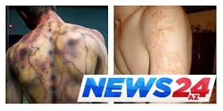 İldırımın izləri - Çox maraqlı FOTOLAR