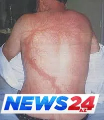 İldırımın izləri - Çox maraqlı FOTOLAR