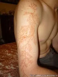 İldırımın izləri - Çox maraqlı FOTOLAR