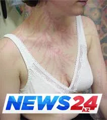 İldırımın izləri - Çox maraqlı FOTOLAR