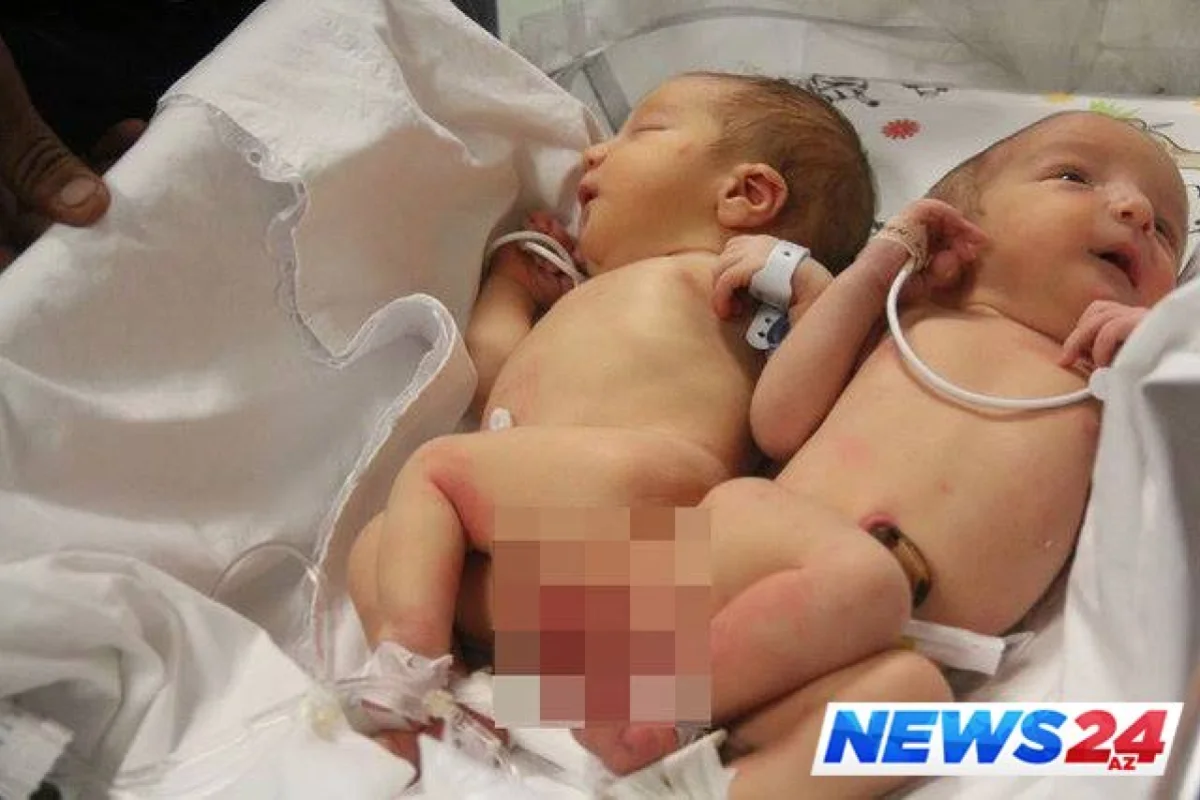 Körpə doğuşdan 3 gün sonra öldü - Ölüm kağızına ölü doğulduğunu yazdılar