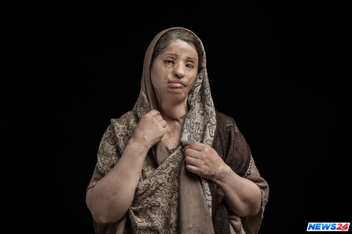 Ərinin cinsi istəyinə yox deyənin üzünü yandırırlar - Dünyada qadın olmaq...