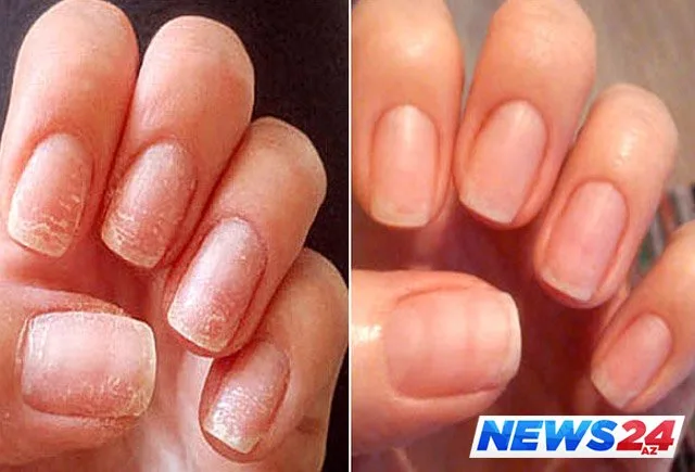 Gel - şellak tipli dırnaq boyalarının qorxunc zərərləri - FOTO