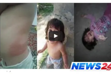 Azyaşlı qızına dəhşətli işgəncə verən ata tutuldu – VİDEO
