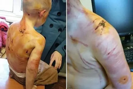 Azərbaycanlı ata dörd yaşlı ögey qızını vəhşicəsinə döydü - FOTO/VİDEO