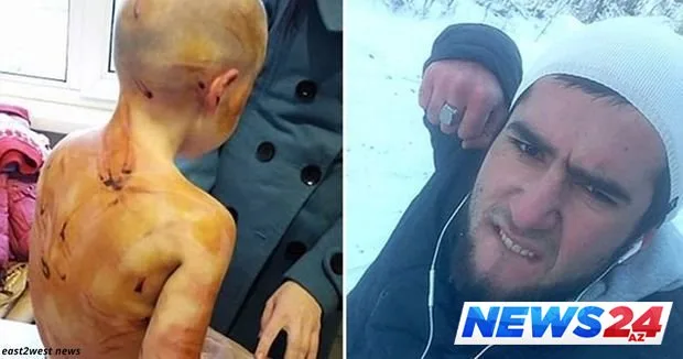 Azərbaycanlı ata dörd yaşlı ögey qızını vəhşicəsinə döydü - FOTO/VİDEO