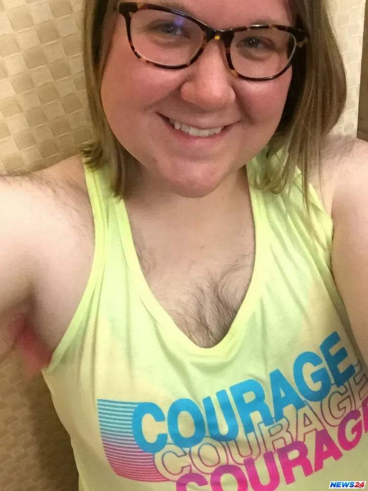 Bütün bədəni tüklə örtülü olan qadın çılpaq fotolarını paylaşdı - FOTO