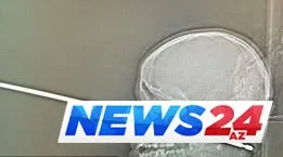 10 yaşlı uşağın başına şiş batdı -FOTO