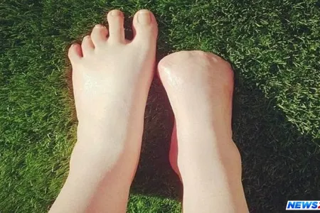 Gözəlləşmək istəyirdi, barmaqlarını itirdi - VİDEO