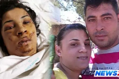 Boşandığı arvadının üzünü şüşə ilə kəsdi