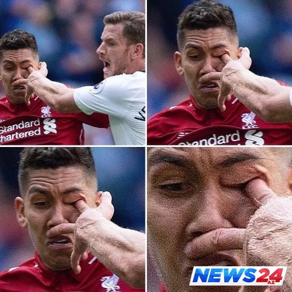 Oyun zamanı məşhur futbolçunun gözü deşildi - VİDEO