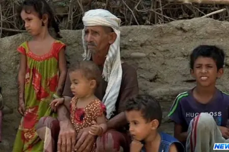 Genetik pozğunluq bir kəndi kor etdi - VİDEO