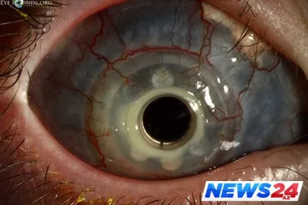 Bu uşağın gözləri görənləri heyrətə salır