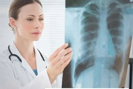 ÜST dünyanın ən öldürücü xəstəliyinin adını açıqladı