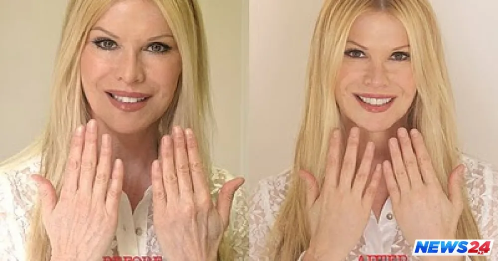 Bu qadın 52 dəfə plastik əməliyyat etdirib - Anası görsə tanımaz