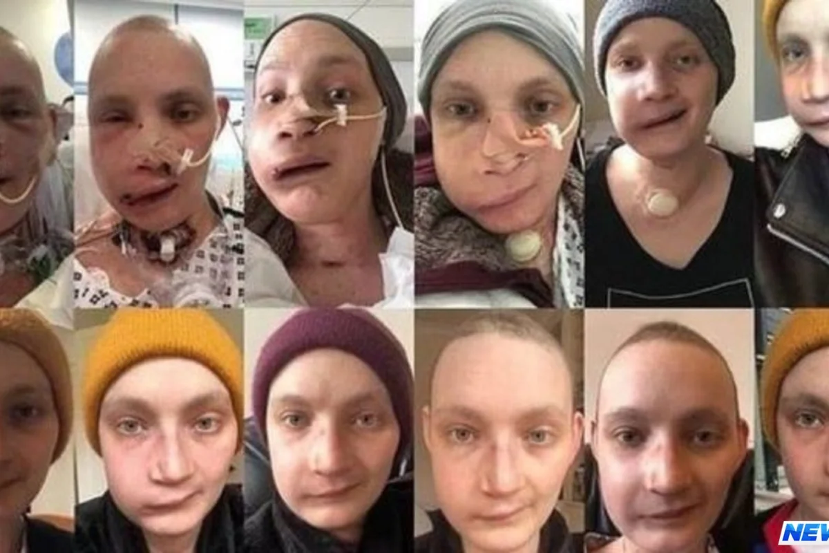 Üz əməliyyatı həyatını dəyişdi