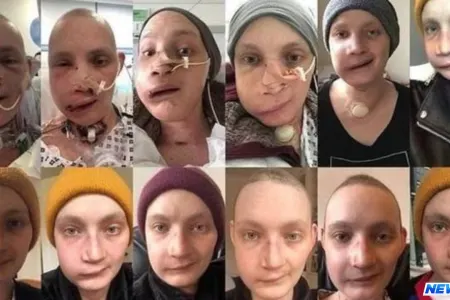 Üz əməliyyatı həyatını dəyişdi