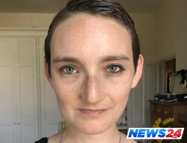 Üz əməliyyatı həyatını dəyişdi