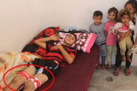 "Facebook"da şərh üstündə dava - 18 yaşlı oğlan bu hala düşdü - FOTO